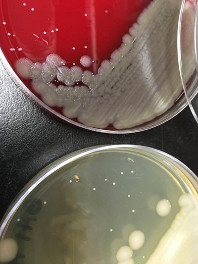 Microbial isolates from pediatric stool samples. Courtesy of Jessica McCann.