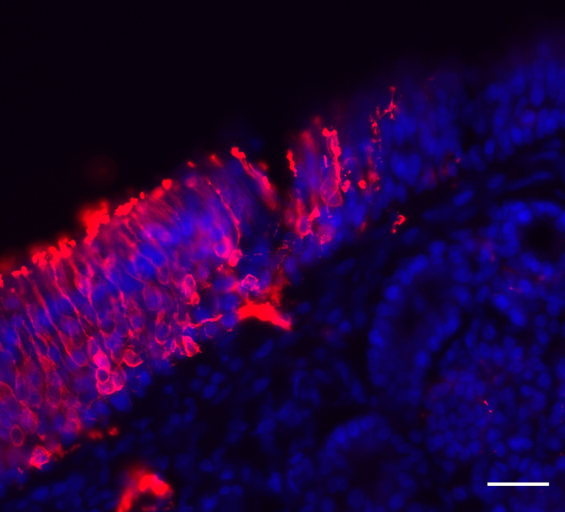 human olfactory neurons