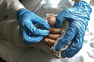 Two Blue gloved hands holding a bandaged hand