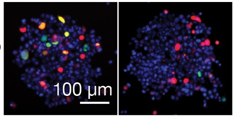 Microscopic image of extra-chromosomal DNA in cancer cell lines
