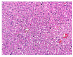 Representative H&E staining of the liver of Gcdh-/- mice after four days on high-protein diet.