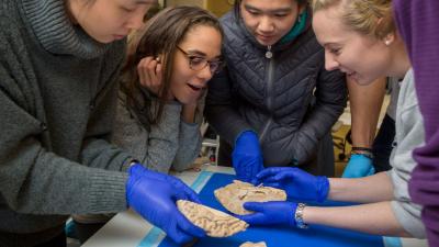 medical students look at a brain