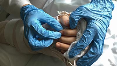 two blue gloved hands holding a bandaged hand