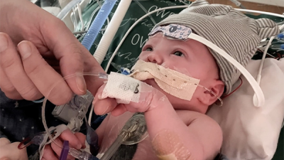 baby in a bassinette wearing a hat with various medical sensors attached