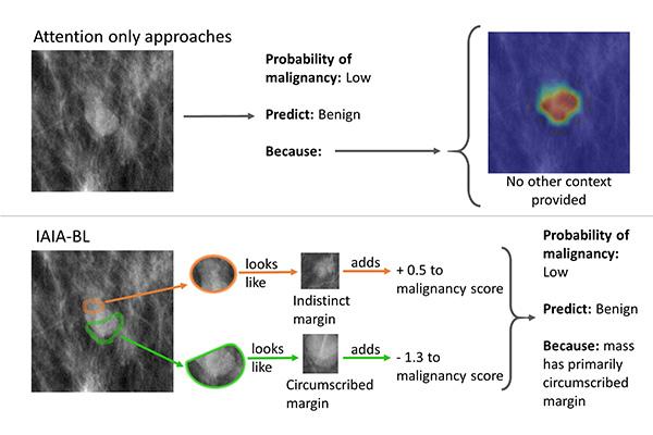 A new AI platform (bottom) not only tells doctors where it’s looking, but which past experiences its using to draw its conclusions.