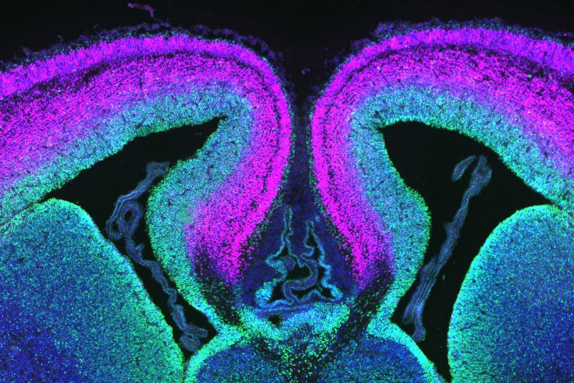 A cross section of mouse cerebral cortex with progenitor cells labeled green and neurons in magenta. (Debra Silver Lab, Duke University)