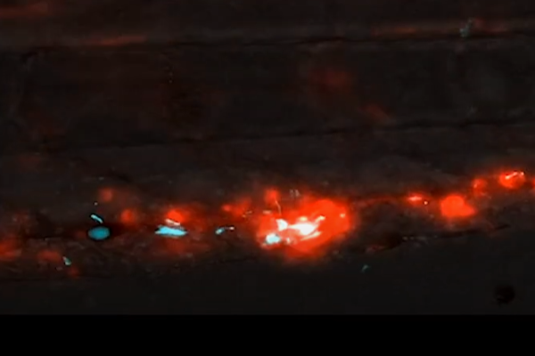 Blebbing Microphages