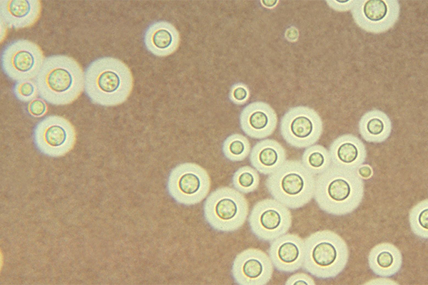 Cryptococcus neoformans fungi