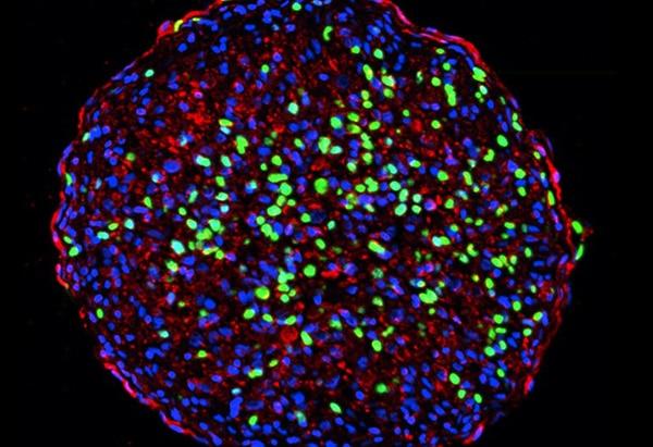 wo cross sections of engineered rat cardiac tissue showing the BRAF mutation at work. 