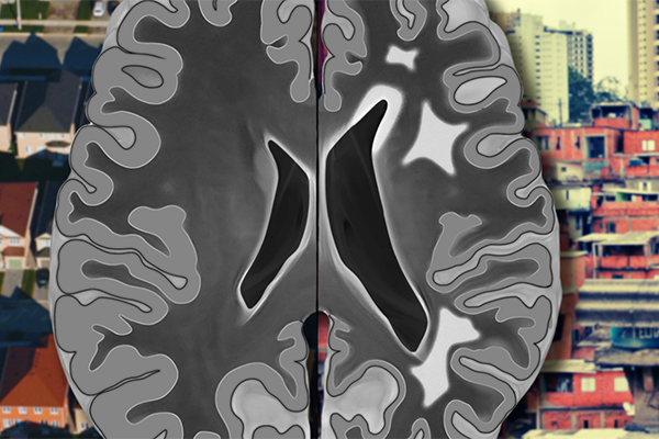 graphic of a slice of brain