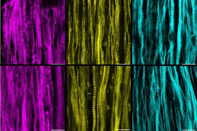 Muscles grown from stem cells 