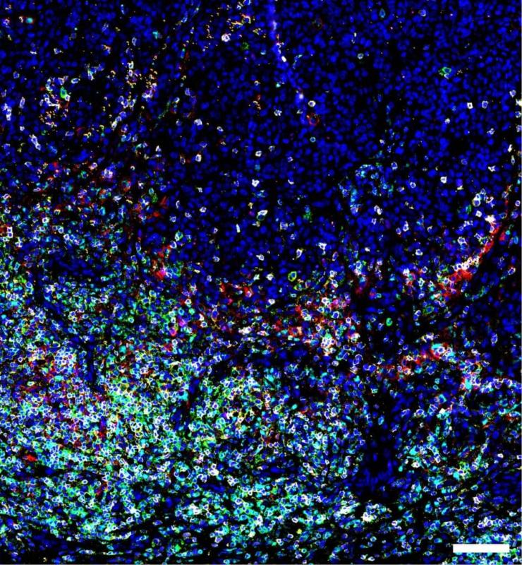 Multiplex imaging image of proteins and molecules