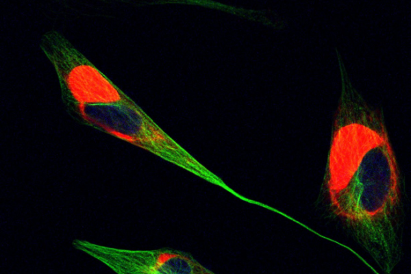 GAN Cells: Red shows excess vimentin | Blue shows excess DAPI | Green shows excess tubulin