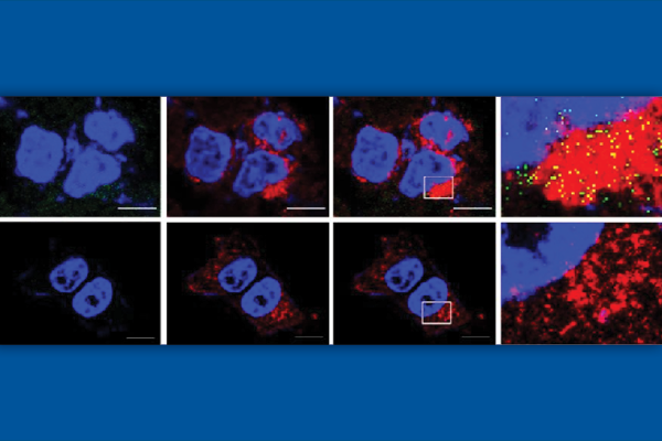 View of cells lit up under a microscope. 