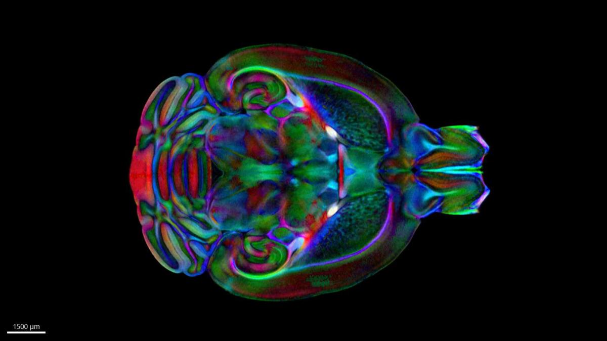An image of the mouse brain from the Duke Mouse Brain Atlas