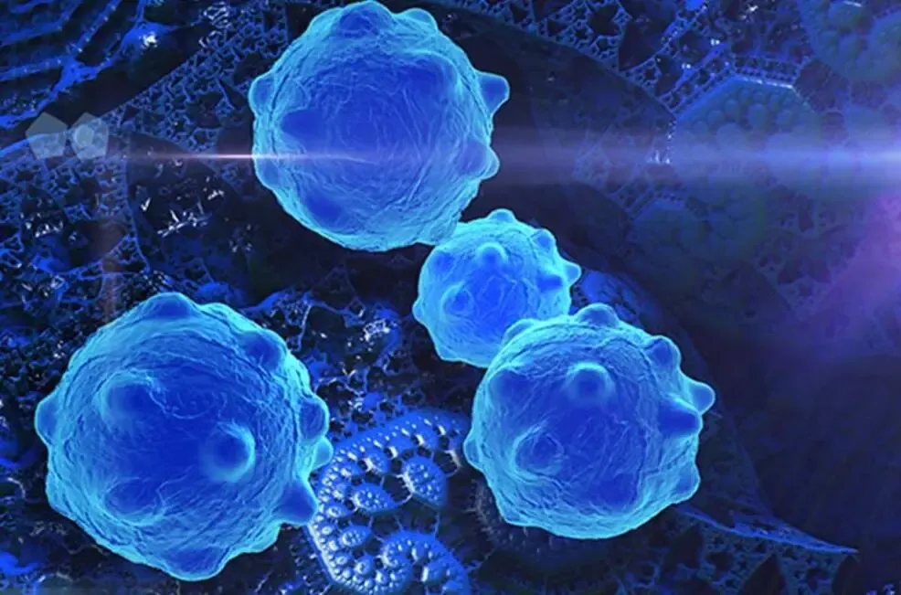 Image of brain tumor cells