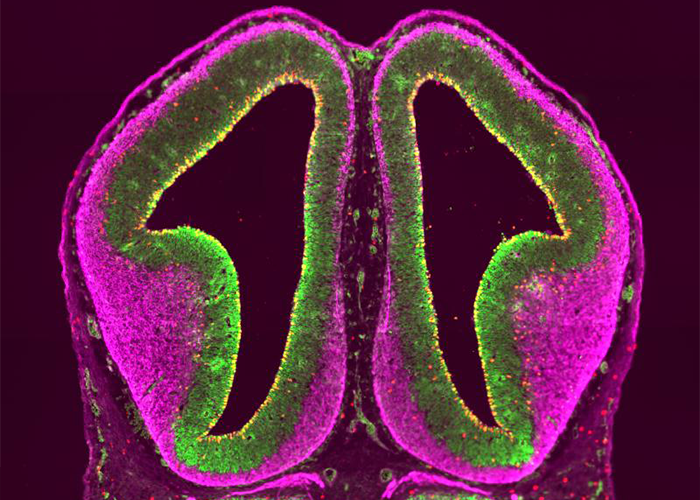 Mouse cortex