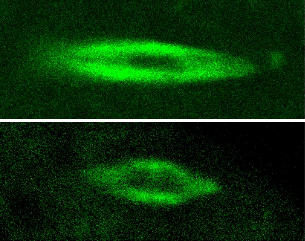 Spindles, which help organize cell division, fluorescing green.