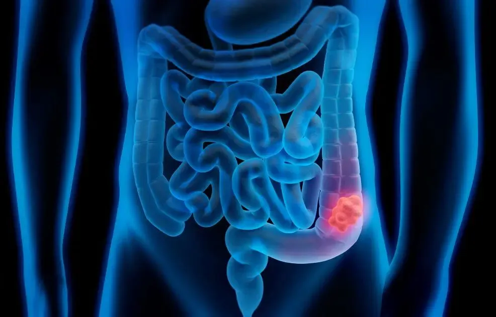stock image of human colon