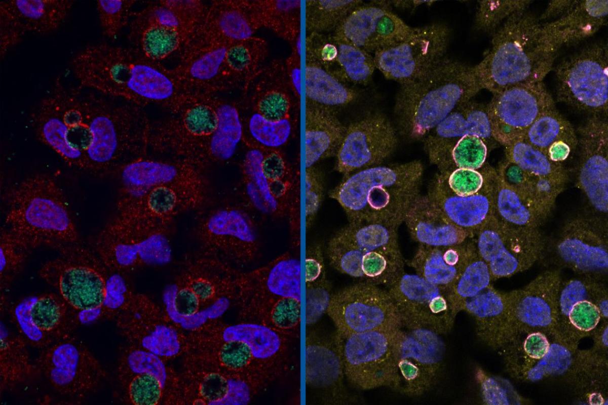 Chlamydia cells surrounded by the GarD protein that cloaks it from detection. Right: Chlamydia cells with GarD knocked out enveloped by antimicrobial ubiquitin proteins and RNF213 