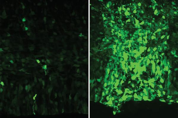  The fluorescent glow of mouse brain cells on the right indicates the effectiveness of a human-derived gene enhancer, HAQER0059, versus a 6 million year old version of the enhancer at left. (Riley Mangan, Duke University)