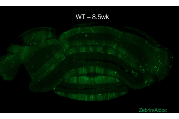 striped pattern on purkinje cells