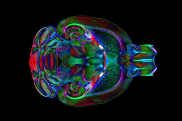 An image of the mouse brain from the Duke Mouse Brain Atlas