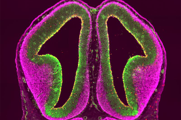 Mouse cortex