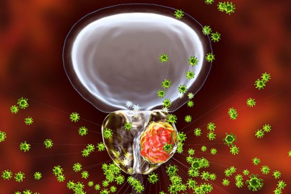 Illustration of a cancer cell