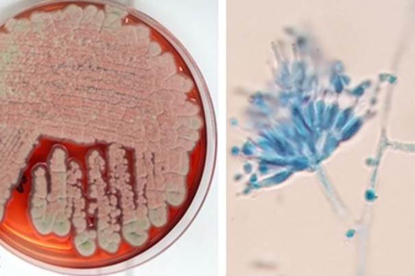 Fungus growing in a petri dish - one of the  life stages of the fungus Talaromyces marneffei, which causes an opportunistic infection in people with compromised immune systems.