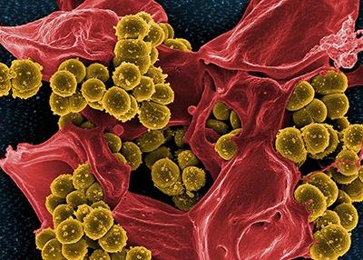 Methicillin-resistant Staphylococcus aureus bacteria (colored yellow) on a dead human white blood cell (colored red).NIAID