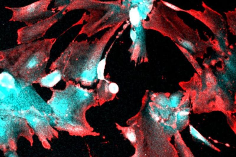 Human kidney cells