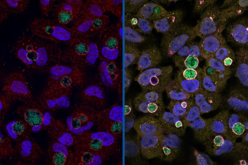  Chlamydia (green) surrounded by the GarD protein (red) that cloaks it from detection. Right: Chlamydia with GarD knocked out (green) enveloped by antimicrobial ubiquitin proteins (yellow) and RNF213 (magenta). (Stephen C. Walsh, Duke University)