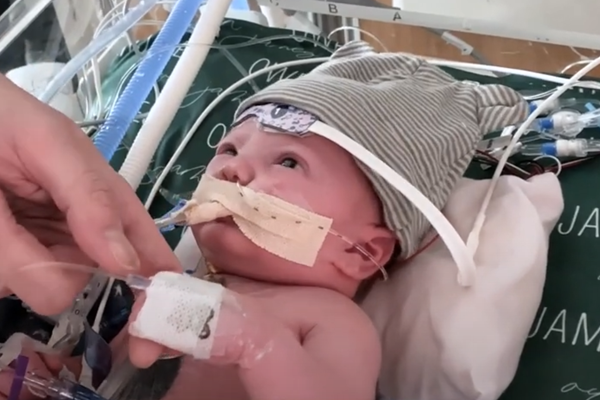 alert infant in an hospital bassinette, wearing a cap, with tubes coming out of his mouth..