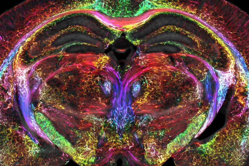 high resolution scan of a mouse brain