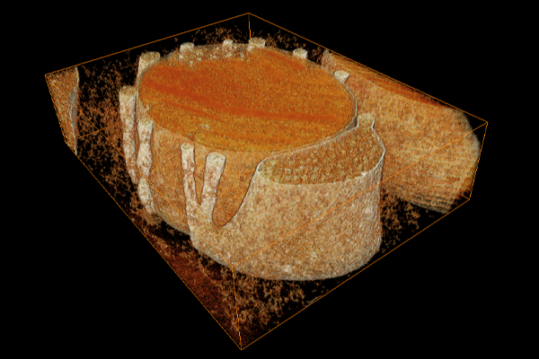 The accessory inner segment (aIS) of the eye.