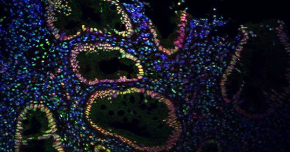 How Nerve Stimulation Could Ease Inflammatory Bowel Disease How Nerve Stimulation Could Ease Inflammatory Bowel Disease