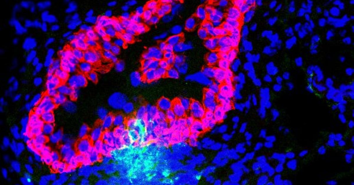 Goodbye UTIs Duke scientists develop vaccine strategy for urinary