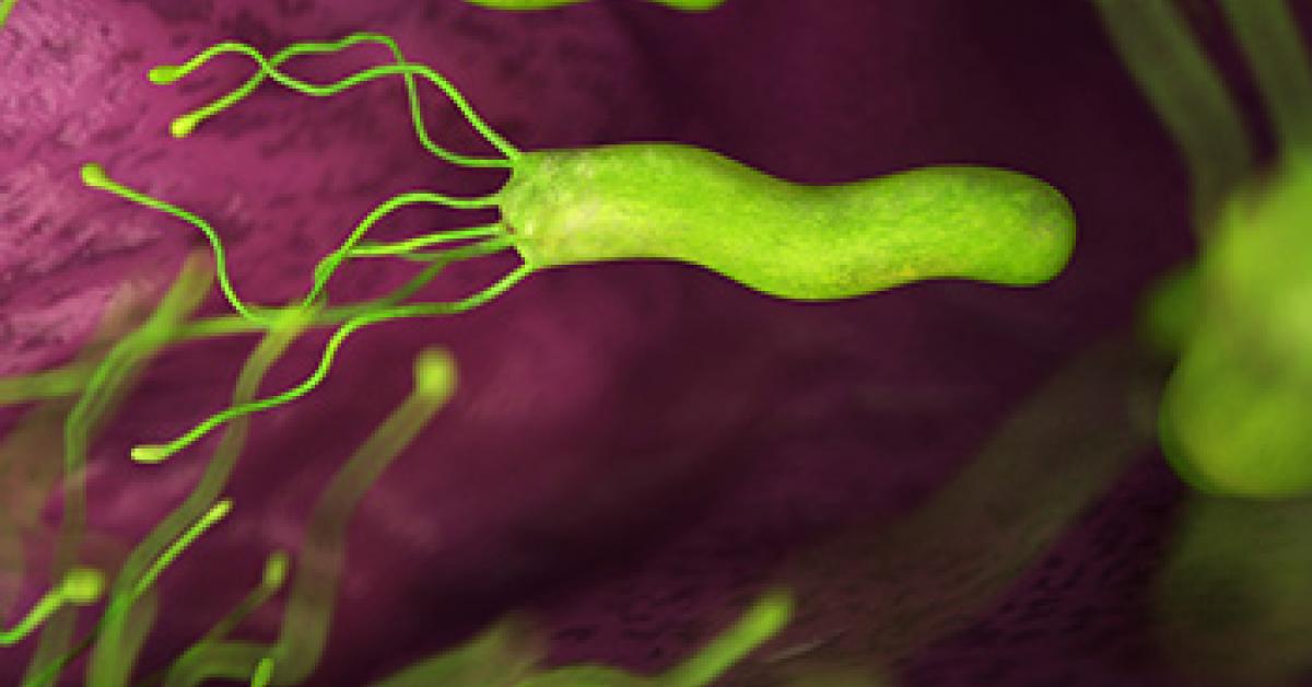 Bug That Causes Stomach Cancer Could Play a Role in Colorectal Cancer ...