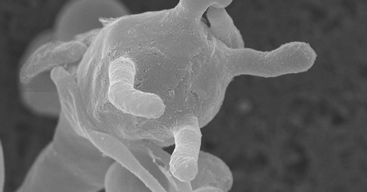 Грибок ног под микроскопом Hypermutators' Drive Pathogenic Fungi to Evolve More Rapidly Duke University Sch