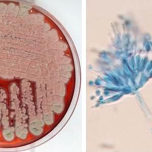 Fungus growing in a petri dish - one of the  life stages of the fungus Talaromyces marneffei, which causes an opportunistic infection in people with compromised immune systems.