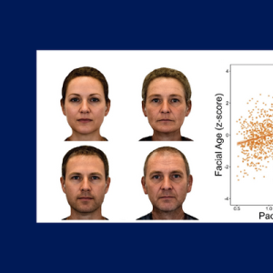  Left side: four faces. Top row has side by side female faces. left picture younger, right picture older. Bottom row is side by side of male faces. left picture younger, right picture older. Right side: a scatter graph of facial aging versus the pace of aging generally showing that the older a person looks, the faster their pace of aging.