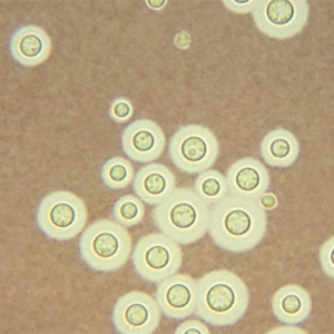 Cryptococcus neoformans fungi