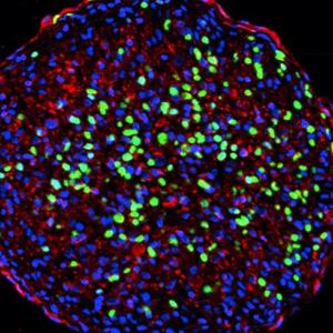 cell with BRAF mutation that is beginning cell division
