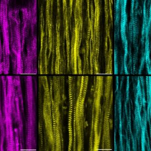 Muscles grown from stem cells 