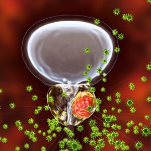 A microscopic image of prostate cancer cells