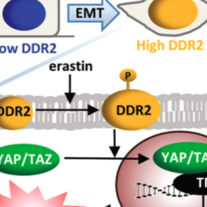 cancer tumor diagram highlighting how ferroptosis works