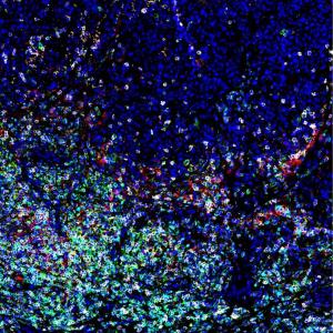 Multiplex imaging image of proteins and molecules