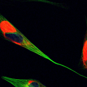 GAN Cells: Red shows excess vimentin | Blue shows excess DAPI | Green shows excess tubulin