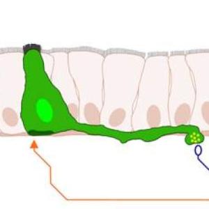 graphical abstract of the gut brain axis